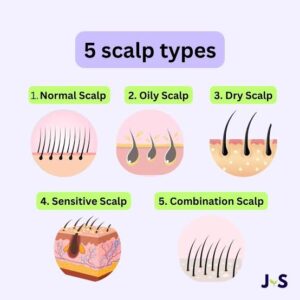 Scalp Types