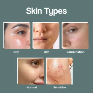 Skin Type