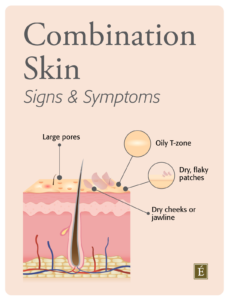 Signs of Combination Skin