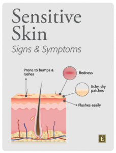 Signs of Sensitive Skin