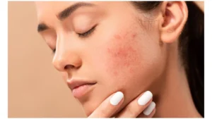 Dark Spots