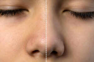 Large Pores