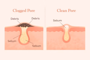 Common Mistakes That Can Make Pores Look Worse