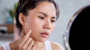 Tiny Bumps on the Face